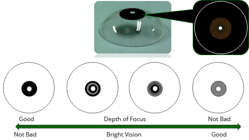 pinhole soft contact lens