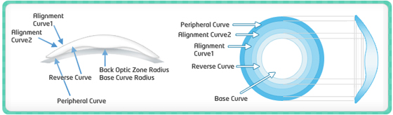 ortho-k-lk-lens-lens-contact-lens-tradekorea