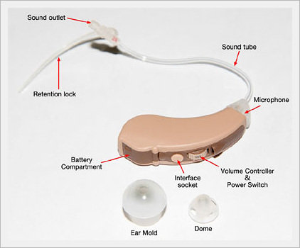 Digital Hearing Aids Diagram Digital Hearing Aid Dsp ic