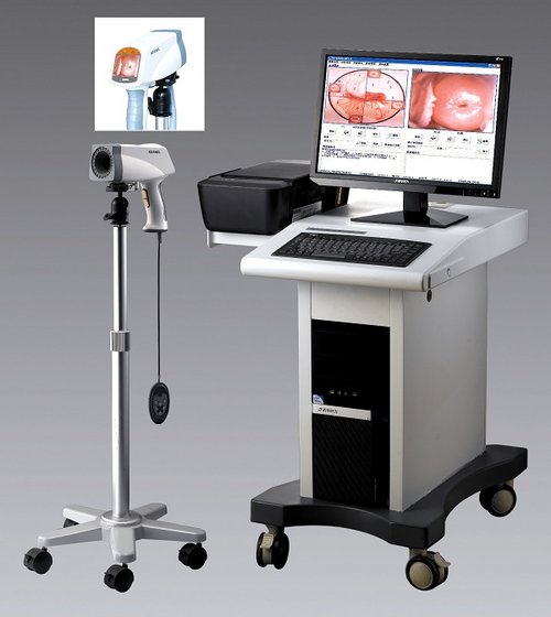 Colposcope Digital Imaging System KN-2200