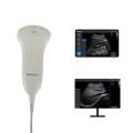 Healson Pocket Ultrasound Mini Handheld Portable Sonography Machine Probe Ultrasound Scanner