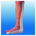 Pre-cut & Roll type orthopedic splint (Hygia Splint)