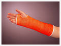 Polyester / Fiberglass Orthopedic Casting Tape