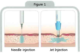 Needle Free Injection (Comfort-in)(id:7144894). Buy Korea Needle Free ...