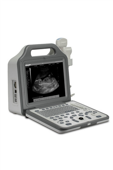 N2 Full Digital Ultrasound System(id:10202013). Buy China 6.5kg, Efci 