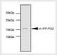 Monoclonal Anti-human IPP (POZ Domain) Antibody