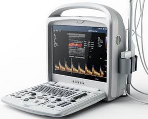 Wholesale color ultrasound scanner: Portable Ultrasound Scanner