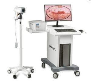 Wholesale lcd tv stand: Vagina Examination Video Colposcope Machine for Gynecology