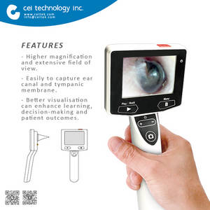 Wholesale charger: Hand-held Digital Vedio Otoscope