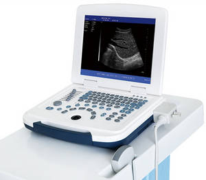 Wholesale color ultrasound scanner: 3D 4D Color Doppler Ultrasound Scanner