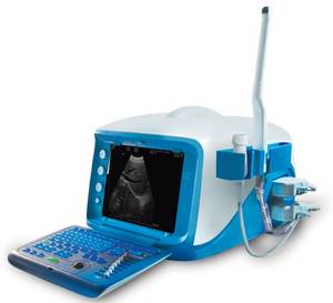 Wholesale portable ultrasound scanners: Portable Digital Ultrasound Scanner SH1000