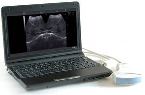 Wholesale whole body scan: Notebook Digital Ultrasound Scanner