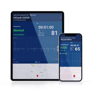 Wholesale patient monitor: HiCardi - SmartView (Mobile Cardiac Telemetry)
