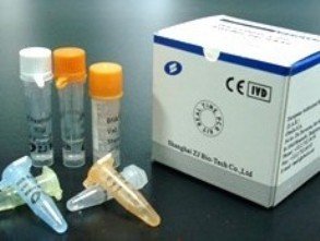 H1N1 Real Time RT-PCR Kit(id:5334820). Buy China Avian Influenza virus ...