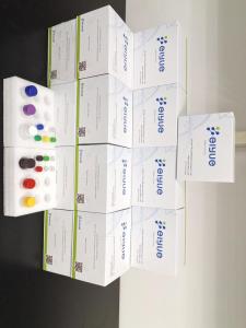 Wholesale spectrophotometer: FY-EH4413 Human Anti-immunodeficiency Virus Antibody,HIV ELISA Kit(1)(2)