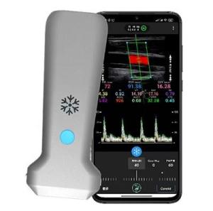Wholesale doppler ultrasound system: WiFi 12.6cm Remote Portable Doppler Ultrasound Machine 30 Fps