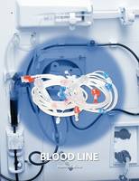 Hemodialysis Bloodline/ Tubing, AV Fistula Needle 5