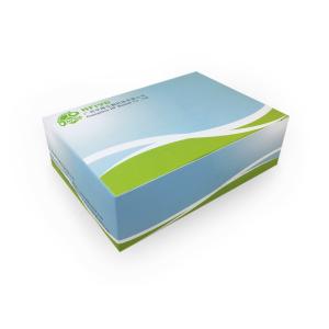 Wholesale tissue boxes: Leptospira(Lep)Nucleic Acid Detection Kit(Freeze-dried/Qpcr Method)