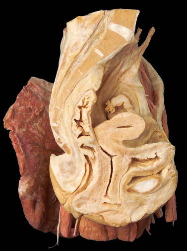 Lifesize Median Sagittal Section Human Female Pelvic Cavity Structure Model  _ - Alisa