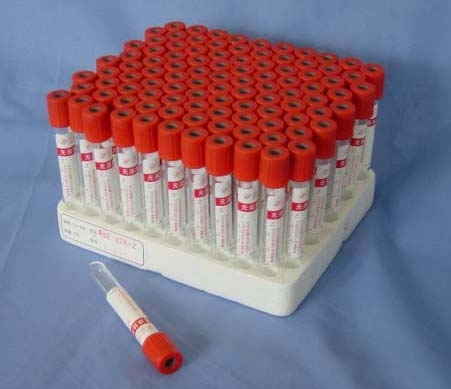 High Quality Vacuum 2ml EDTA K2 Vacuum Blood Collection Tube with CE(id ...