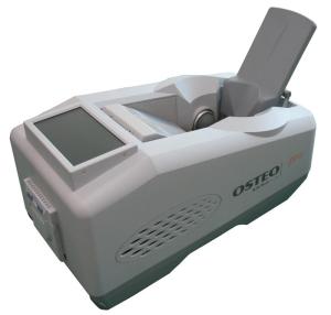 Wholesale system window: Bone Densitometer, Ultrasound Bone Densitometer (All-in-one) Osteopro-Easy
