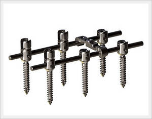 Wholesale spinal surgery: Spinal Fixation System