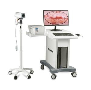 Wholesale palm computer: CE FDA Approved KERNEL KN2200 Digital Video Colposcope for Cervix Vagina Examination