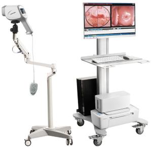 Wholesale led spot: Sony HD Digital Video Colposcope Hospital Digital Colposcope Machine Handheld Electronic Colposcopy