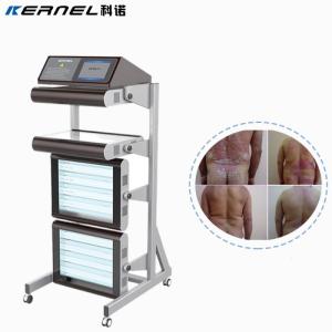 Wholesale i glass video: Kernel KN-4006BL3 308nm UV Radiation Medical Device Vitiligo Psoriasis Eczema Treatment Device