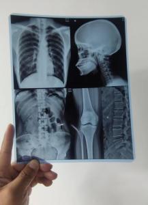 Wholesale pet film: 148 10 14  Inch Dry X-ray Thermal Film, PET Films for Agfa 5302 Fuji Drypix 2000 3500 Lite Printers