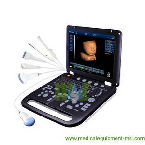 Wholesale digital video: New General 4D Laptop Ultrasound Scanner-MSLCU18