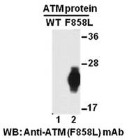 Sell Anti-ATM (F858L) Mouse Monoclonal Antibody