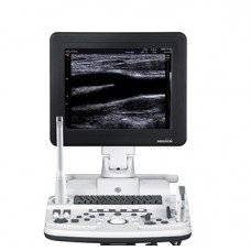 Wholesale ultrasound system: Medison SonoAce R5 Ultrasound System