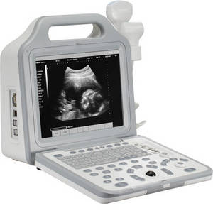 Wholesale ultrasound gel: Ultrasound Scanner WHYC50P Digital Portable ultrasound scanner,big LCD