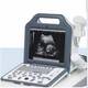 Medical hospital equipment WHYC60P Digital Portable LCD Ultrasound Scanner