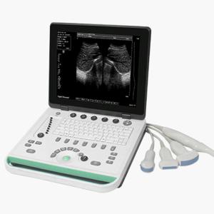 Wholesale ultrasound: Portable Ultrasound System / for Multipurpose Ultrasound Imaging / B/W / Built-in Console DP-50
