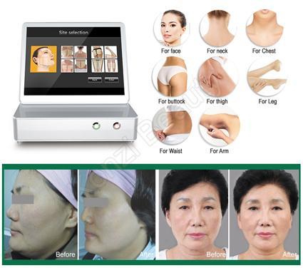 Sell 3D HIFU Face Skin Care Beauty Machine