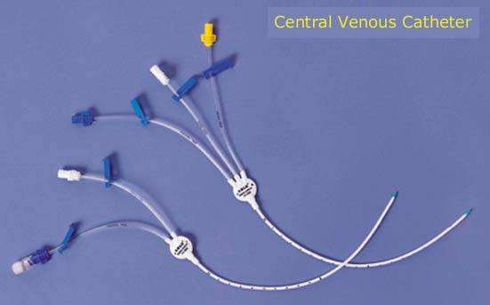 Central Venous Catheter Sites