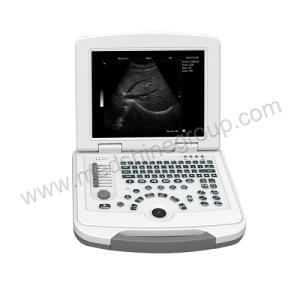 Wholesale ultrasound gel: M200 Convex/Linear/Micro-convex Scan Mode High Performance Portable Ultrasound