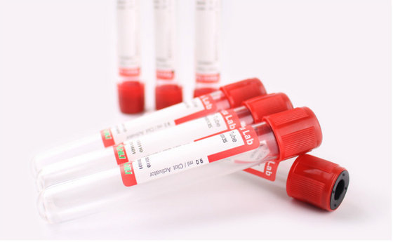 Factory Direct Supply Vacuum Blood Collection Tubes for Single Use(id ...