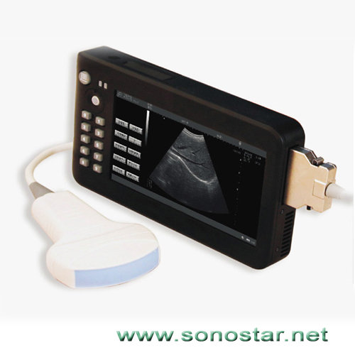 UPAD-2 Tablet Palm Ultrasound B Scanner(id:6801414). Buy China ...