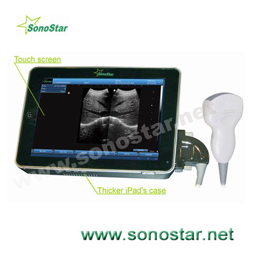 UPAD-10 Tablet PC Based Ultrasound B Scanner((id:6801422) Product ...