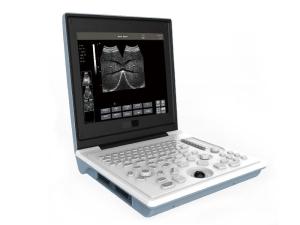 Wholesale led clock: Laptop All-Digital Ultrasound Diagnostic SS-6B