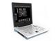 Laptop All-Digital Ultrasound Diagnostic SS-6B