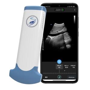 Wholesale handheld ultrasound scanner: Convex Probe