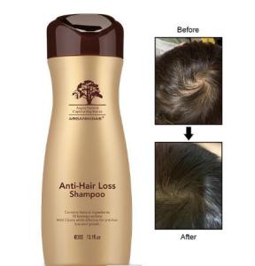 Wholesale hair shampoo: ARGANMIDAS Anti-Hair Loss Shampoo, Hair Growth Shampoo for Hair Loss Caused by Perm and Pressure