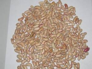 Wholesale kidney beans: Light Speckled Kidney Bean