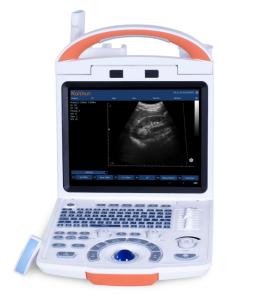 Wholesale obstetric operating table: Smart Portable Type Digital Color Doppler Ultrasound Scanner for Human Use