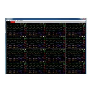 Wholesale monitoring system: Central Monitoring System (Sofrtware)