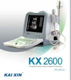 B Mode Ultrasound Scanner for Human Use (KX2600)